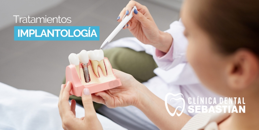 Implantología