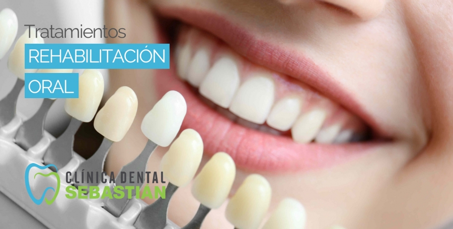 Rehabilitación Oral